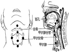 甲状腺激素抵抗综合征