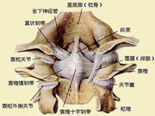 单侧关节突关节脱位