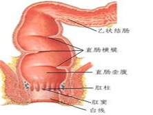 直肠损伤