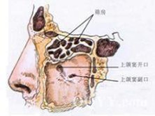 筛窦恶性肿瘤