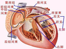 二度房室传导阻滞