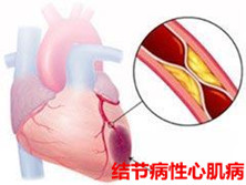 结节病性心肌病