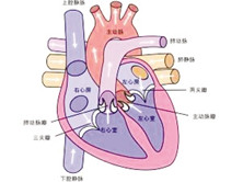 老年风湿性心脏病