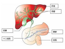 胆管狭窄