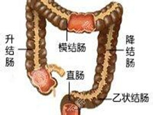 结肠过敏症