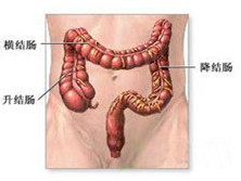 结肠闭锁