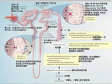 假性醛固酮减少症