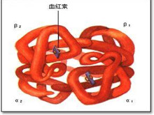 异常血红蛋白病