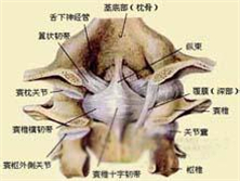 寰枢关节脱位