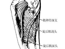 桡神经感觉支卡压