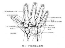 手部血管损伤