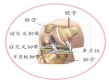 十字韧带损伤