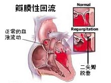 心脏供血不足