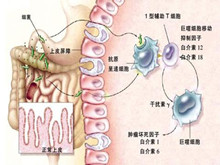 性病相关性胃肠道感染