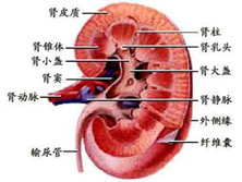 肾盂癌