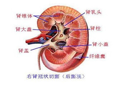 肾性尿崩症