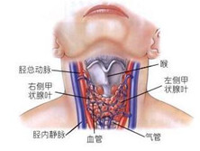 慢性淋巴细胞性甲状腺炎