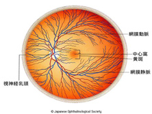 视网膜病变