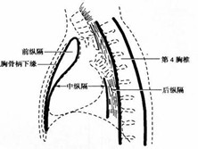 继发性纵隔感染