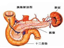 壶腹周围癌