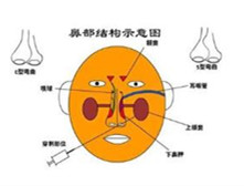 慢性单纯性鼻炎