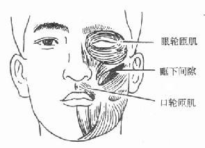 眶蜂窝织炎