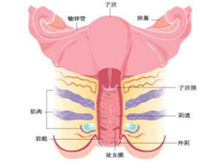 阴道壁息肉