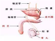 输精管缺如