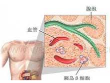 糖尿病前期