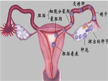 月经失调性不孕症