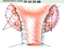 小儿甲状旁腺功能减退症