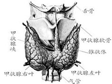 小儿亚急性甲状腺炎