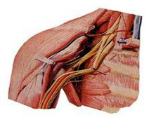 臂丛神经痛