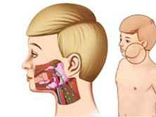 慢性复发性腮腺炎