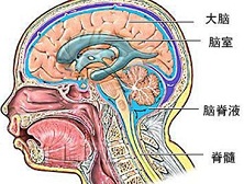 脑室内出血与血肿