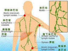 颈部淋巴结转移癌