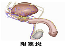 慢性附睾炎