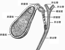 浓缩胆汁综合征