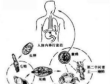 脑肺吸虫病