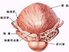 非淋性前列腺炎