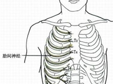 肋间神经痛