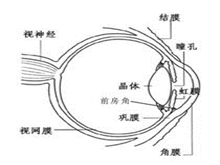 原发性慢性闭角型青光眼