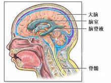 颅内压增高