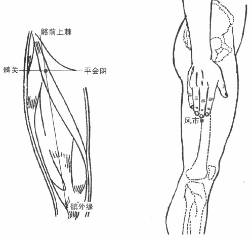 股外侧皮神经炎