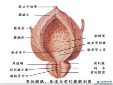 膀胱湿热