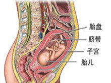 胎儿生长受限