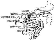 先天性十二指肠闭锁