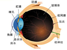 并发症白内障