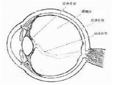 玻璃体及视网膜脱离手术所致青光眼