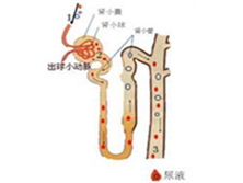 梗阻性尿路疾病